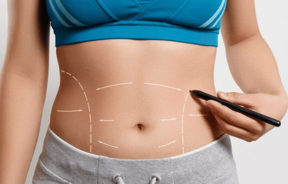 tummy truck in indore, liposuction indore, liposuction treatment in indore