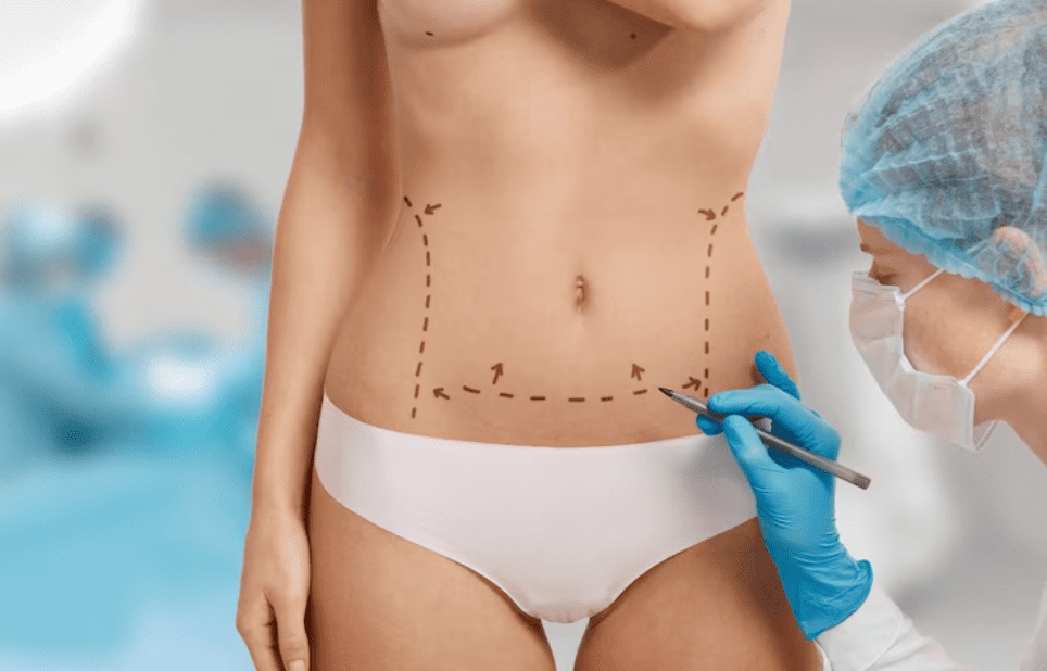 vaser liposuction in indore, liposuction indore, liposuction treatment in indore