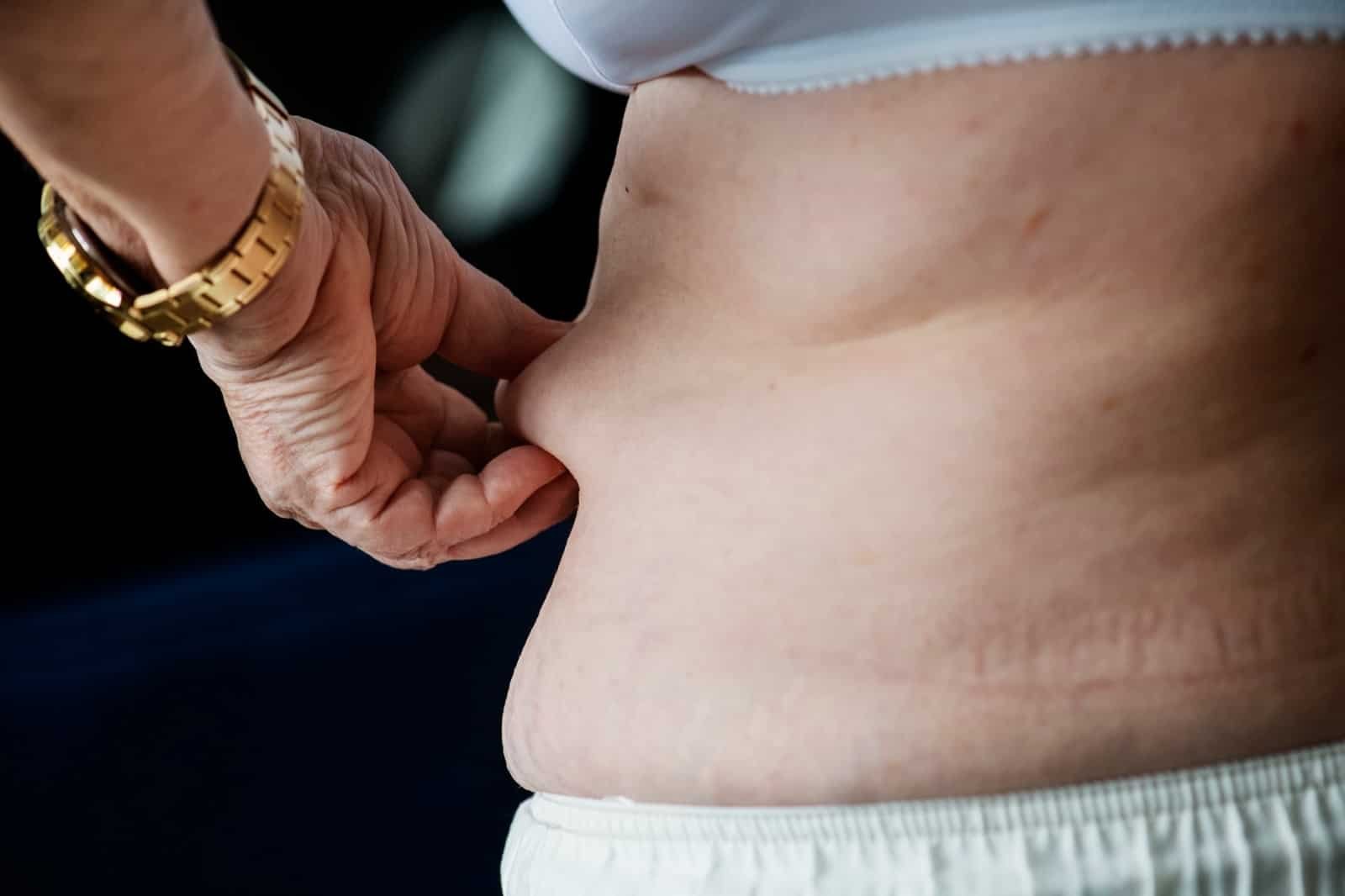 best liposuction in Indore, liposuction indore